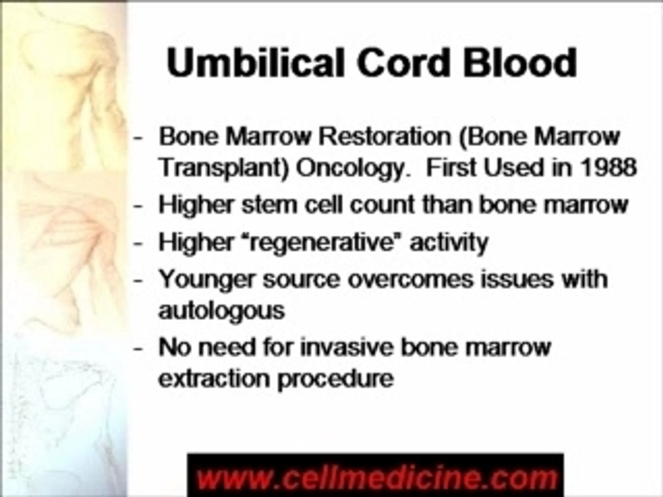 Can You Use Someone Else's Cord Blood Stem Cells