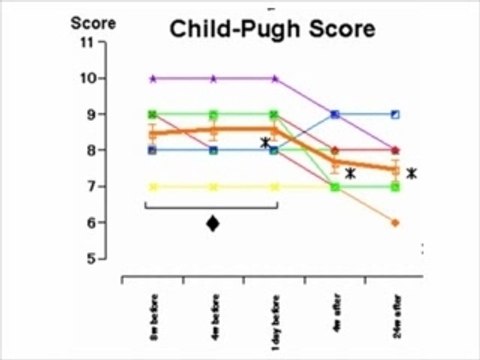 Stem Cell Therapy for Liver Failure