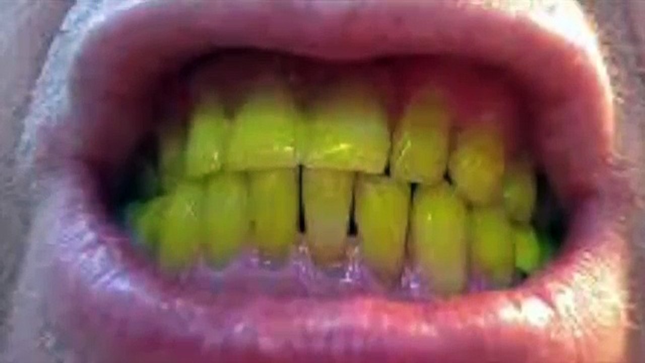 Wrap your teeth with foil and you will not believe the results!