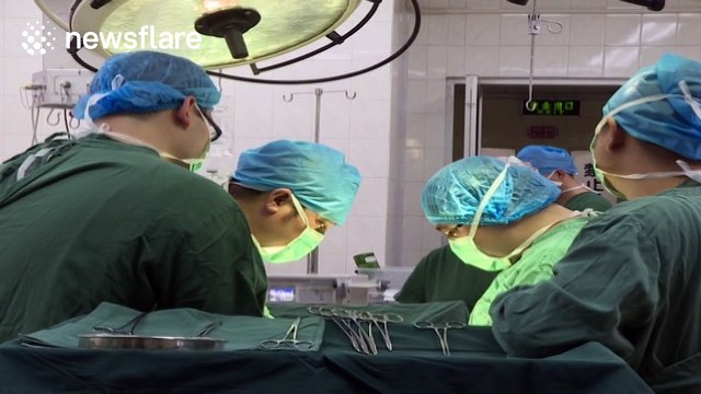 Doctors remove 22 needles from man's stomach