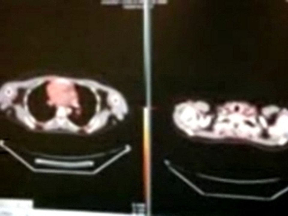 CT comparison
