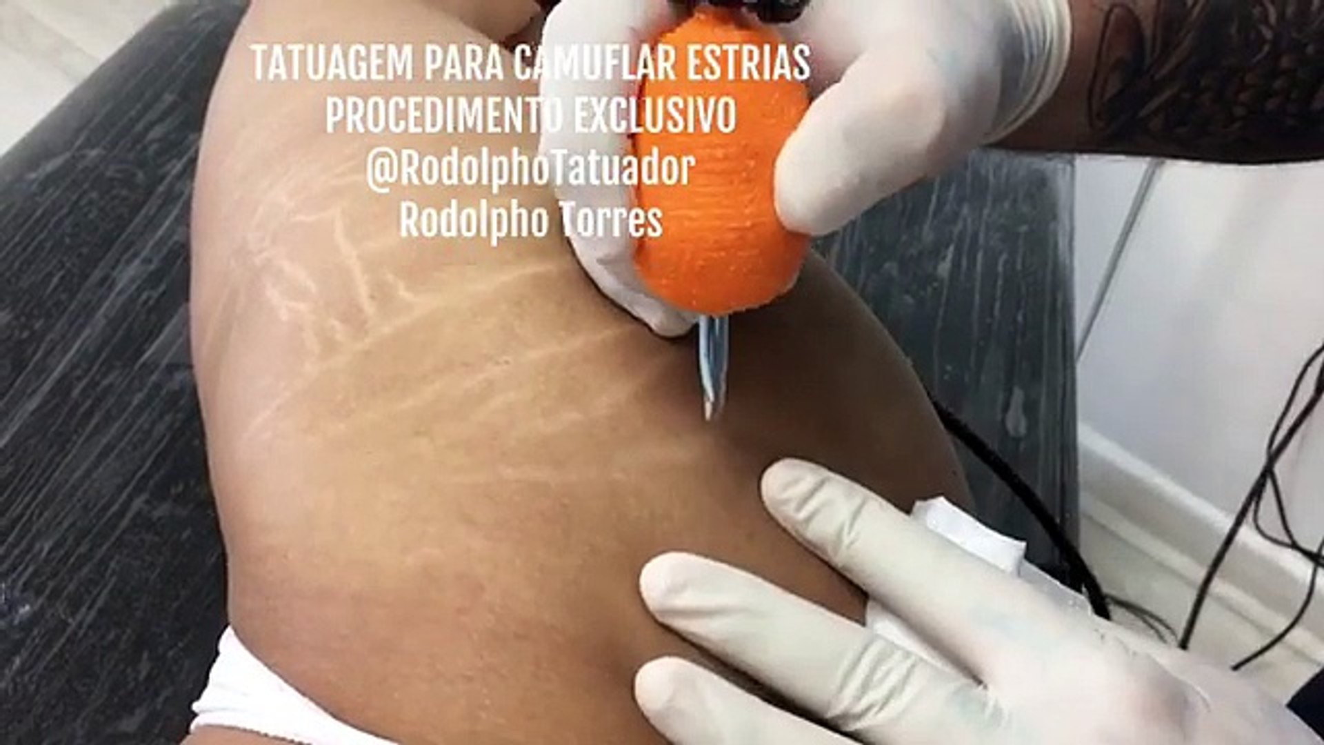Recouvrement Tatouage Ventre Femme Vergeture