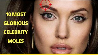 The 10 Most Glorious Celebrity Moles