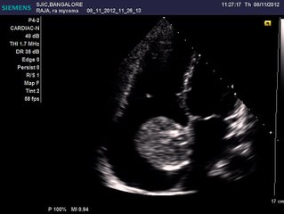 Austin Journal of Clinical Cardiology-1035