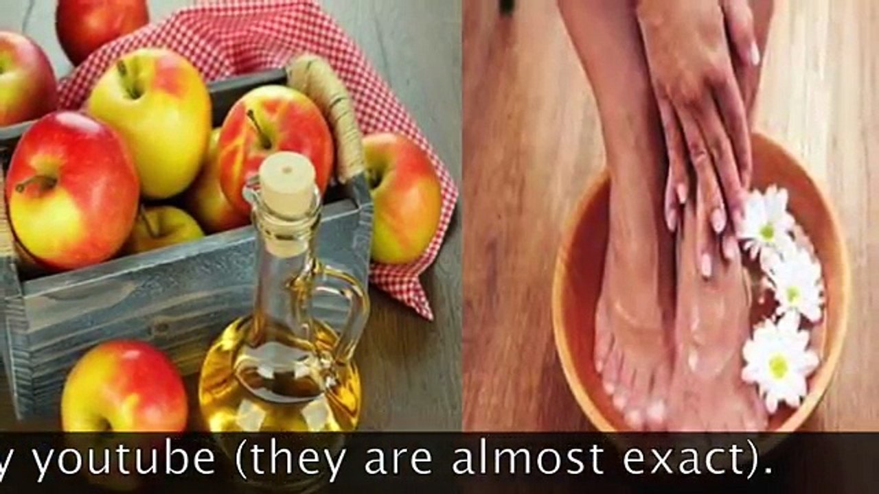 35. This is what happens when you dip your feet in vinegar one night a week. I'm still amazed