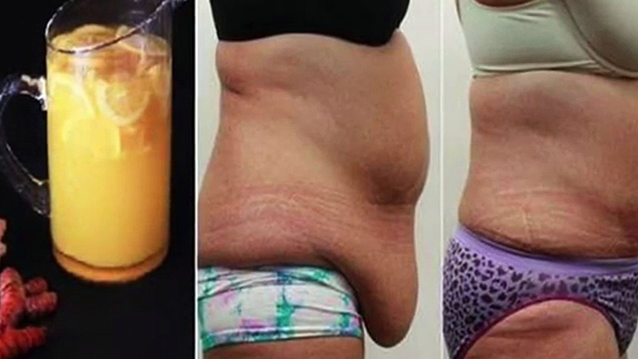 32. She took this to get rid of the fallen belly. Got results in 10 days