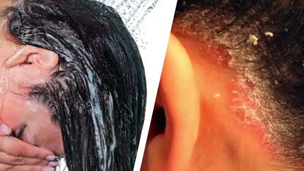 She rubbed an aspirin in her hair.  What happened a few hours later is fantastic