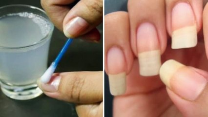 64. She did this and her nails grew quickly. It was told by a friend who is a dermatologist
