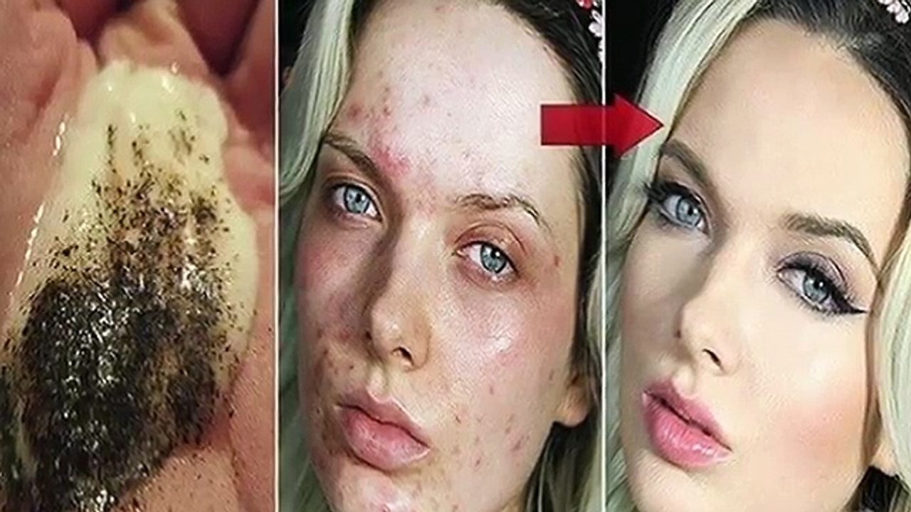 56. When Mixing These 2 Ingredients Look What Happens To Your Skin After Several Minutes. AMAZING