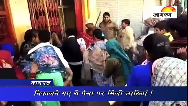 निकालने गए थे पैसा पर मिली लाठियां !