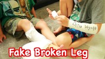 FAKE INJURY PRANK- Fake Broken Arm LEG Toby Fake Sick FUNNY Kids Prank DIY Fake Cast AllToyCollector