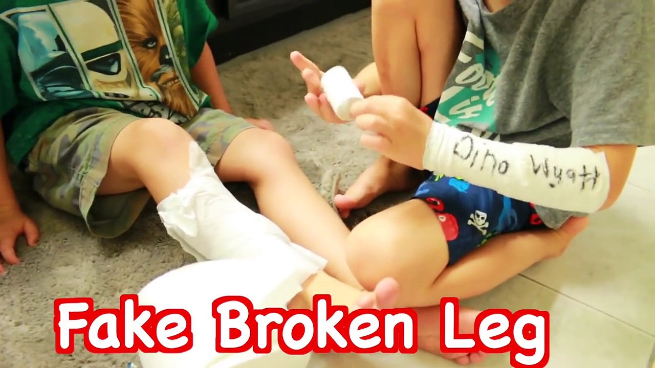 FAKE INJURY PRANK- Fake Broken Arm LEG Toby Fake Sick FUNNY Kids Prank DIY Fake Cast AllToyCollector