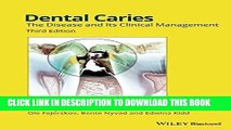 [FREE] EPUB Dental Caries: The Disease and its Clinical Management Download Ebook