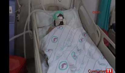 Patlamada kafasına saplanan taş ameliyatla çıkartıldı