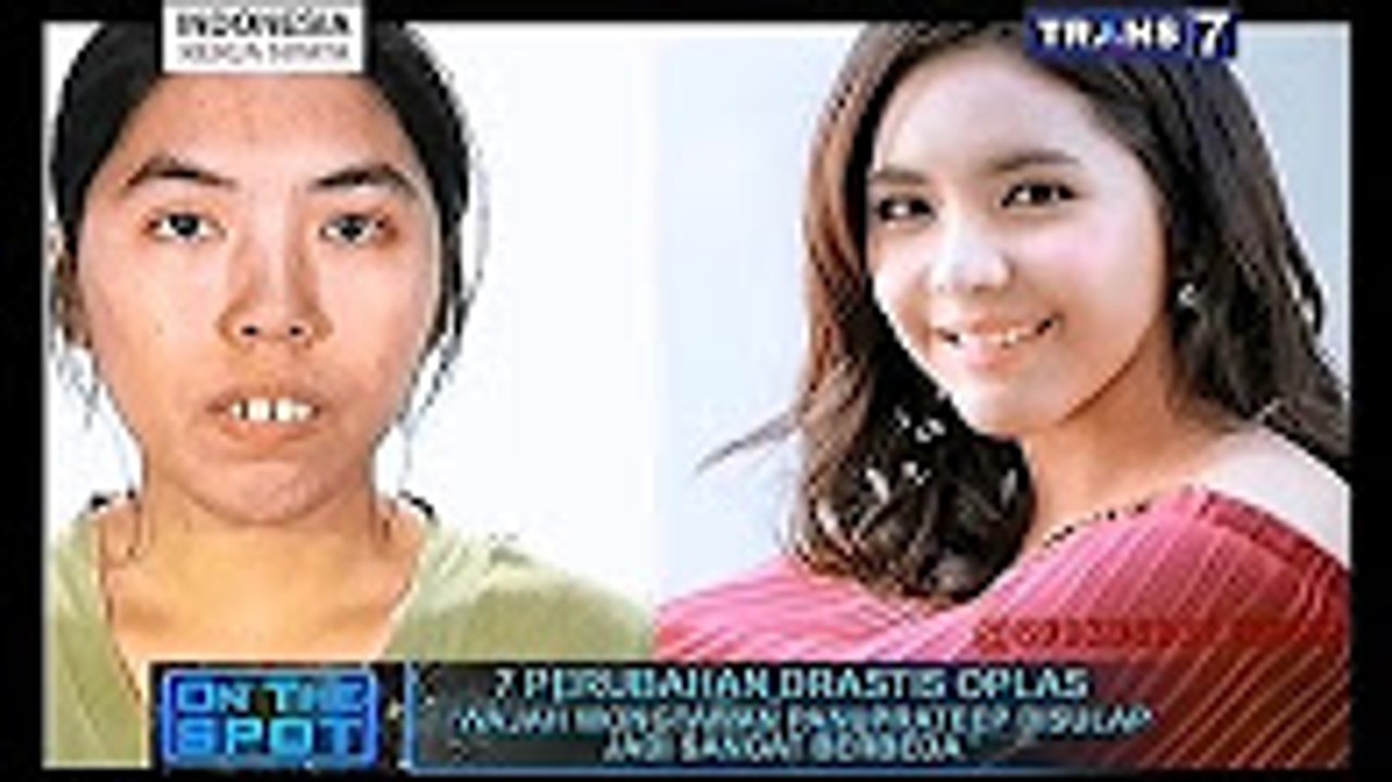 7 Perubahan Drastis Oplas [On The Spot]
