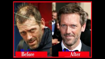 Fixplant Kullanan Ünlüler