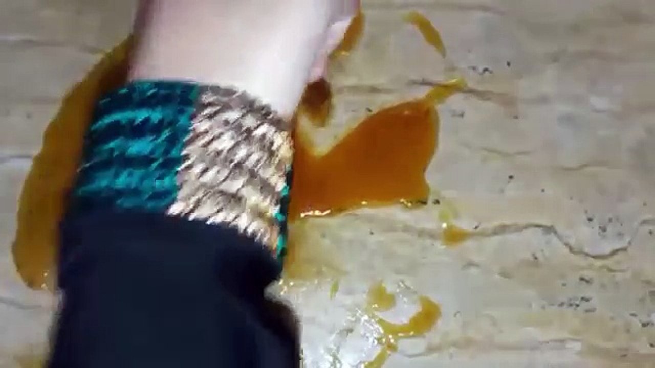 How I removed my armpit hair permanently body hair removal