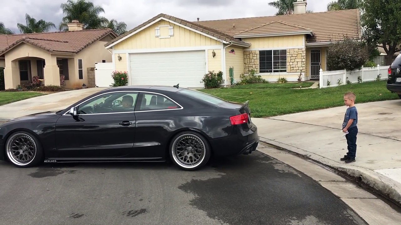 Tooth Pull, Courtesy of Audi S5