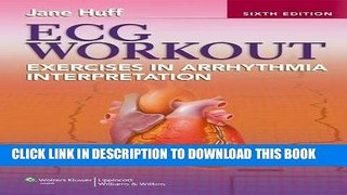 [PDF] ECG Workout: Exercises in Arrhythmia Interpretation (Huff, ECG Workout) Full Online