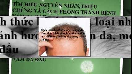 Tìm hiểu nguyên nhân triệu chứng bệnh nấm da đầu