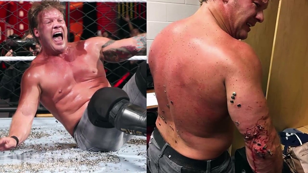 Top 10 Worst Injuries in WWE