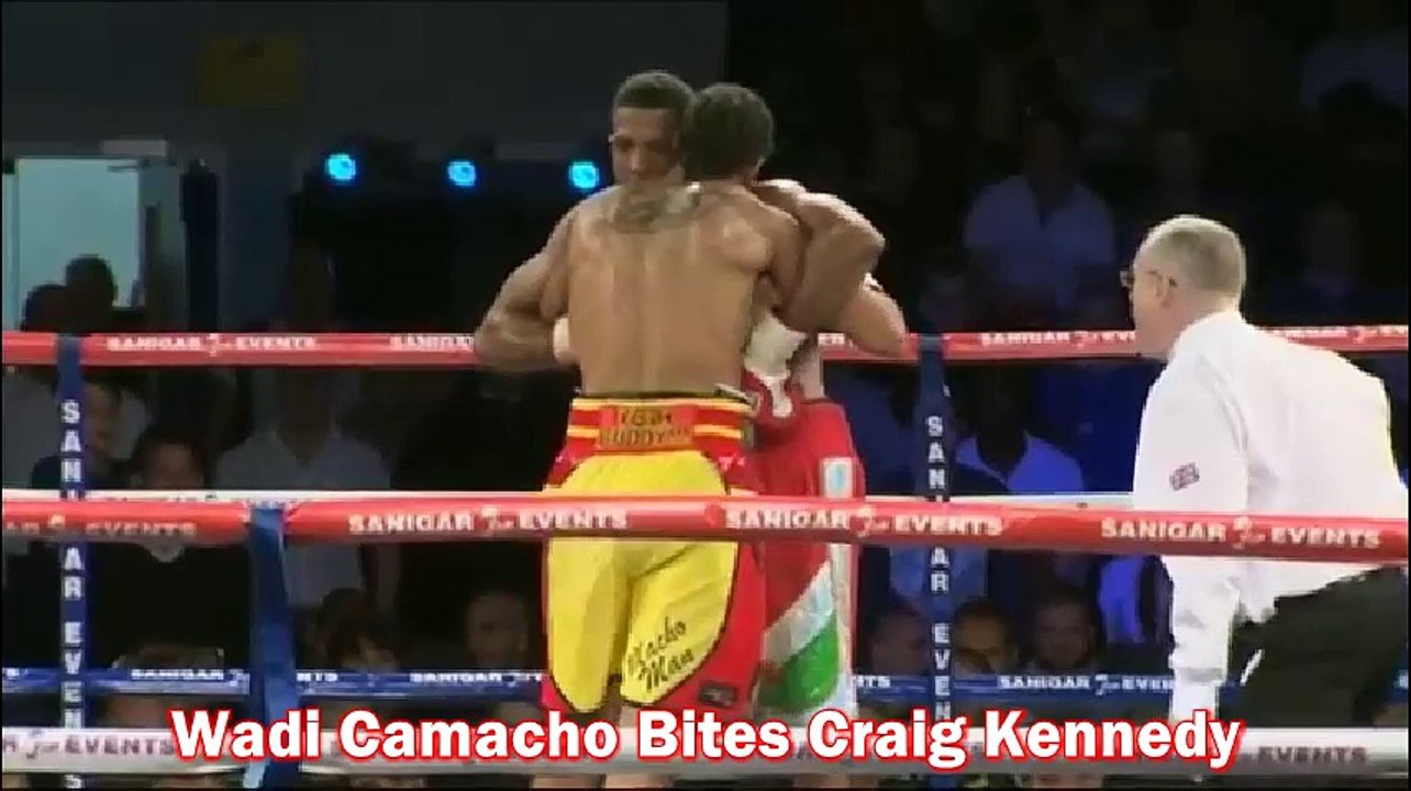 Most Gruesome Bites In Boxing