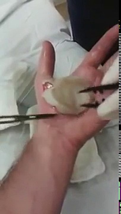 aie