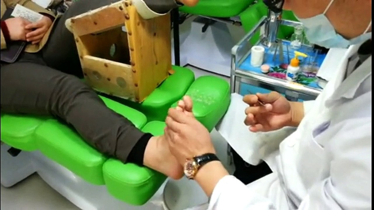 Professional Foot Care (1) Hard Skin Removal and Nail Pedicure