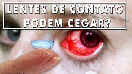 Lentes de Contato podem Cegar