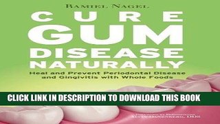 KINDLE Cure Gum Disease Naturally: Heal and Prevent Periodontal Disease and Gingivitis with Whole