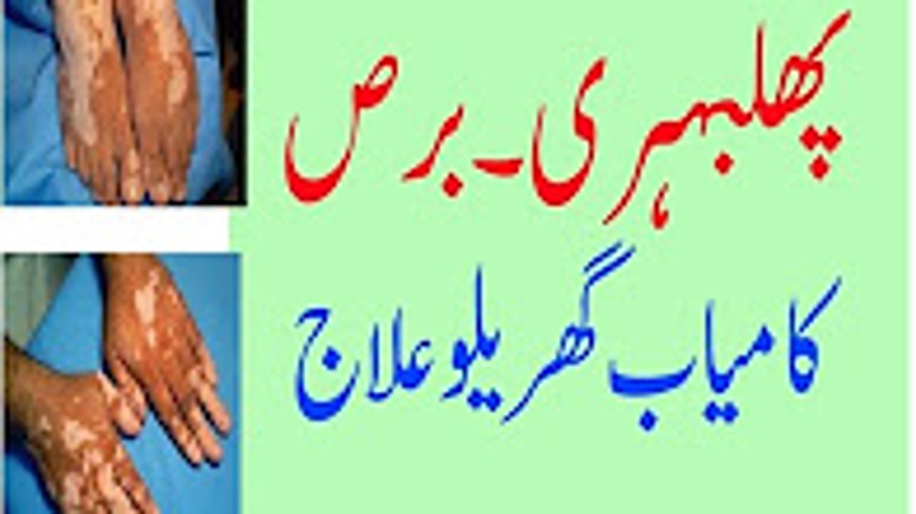 Phulbehri(Barss) Ka ilaj/Phulbehri khatam karne ka desi tarika