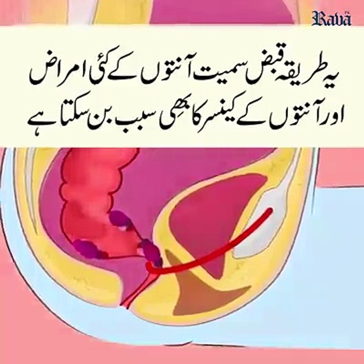 آپ بیت الخلاء میں اپنی پوری زندگی غلط بیٹھتےآےہیں دیکھئے