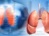 Tuberkuloza - jedan od deset vodećih uzroka smrti, 27. novembar 2016. (RTV Bor)