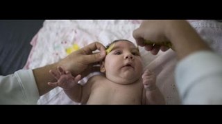 Zika Virus A plague in South America and Africa
