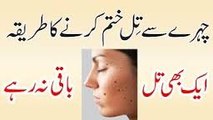 Blackhead Khatam Karne Ka Asan Gharelu Ilaj  How to Remove Blackheads From Nose & Face