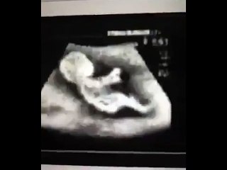 is this your ultra scan =D