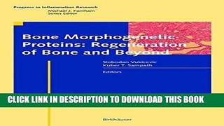 [READ] Kindle Bone Morphogenetic Proteins: Regeneration of Bone and Beyond (Progress in