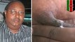 Kenyan pastor has rare disease that makes his breasts produce milk