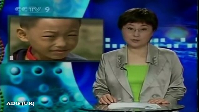 Cet enfant peut voir dans le noir avec ses yeux étonnants !