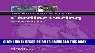 KINDLE The Nuts and Bolts of Cardiac Pacing PDF Full book
