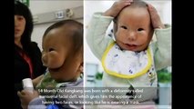 Les docteurs disent à la maman de ne pas être triste. Puis, elle s'évanouit en voyant son bébé.