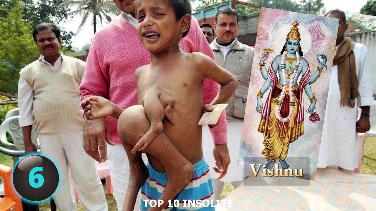 10 Personnes aux Capacités EXTRAORDINAIRE ! INCROYABLE Humains ayant un CORPS HYPER RARE !