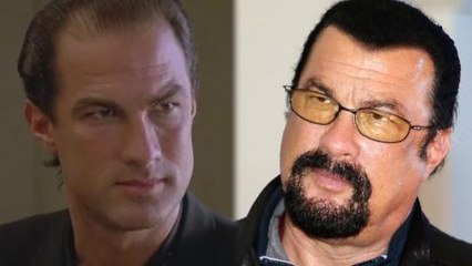 Top 10 Celebrities Who Tried to Hide Going Bald