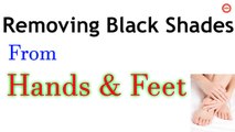 Removing Black Shades on Hands and Feet | Dark Spots on Hands & Feet | Get Flawless Glowing Skin |