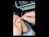 Professional Foot Care (39) Relaxing Treatment of Foot Diseases and Plantar Warts