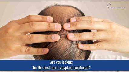 Looking for the Best Hair Transplant Treatment - Drcarloswesley.com