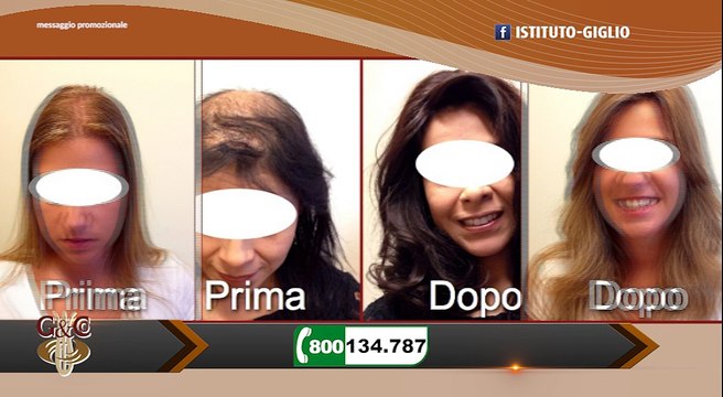 Clara Taormina presenta Istituto Giglio & CO e come risolvere problemi di capelli come calvizie e diradamento