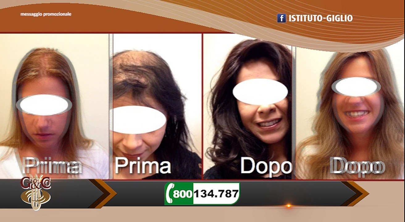 Clara Taormina presenta Istituto Giglio & CO e come risolvere problemi di capelli come calvizie e diradamento