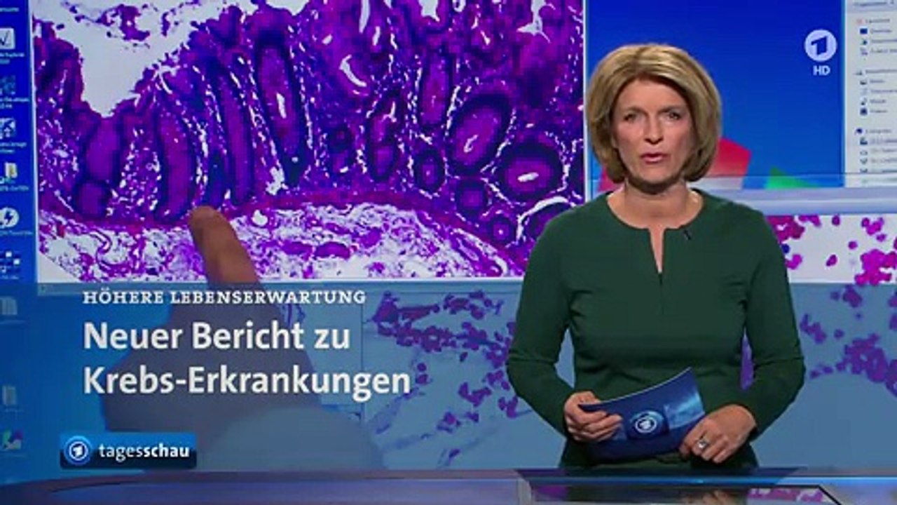 Tagesschau | 29. 11. 2016 16:00 Uhr (mit Susanne Holst) [GANZE FOLGE] | Das Erste