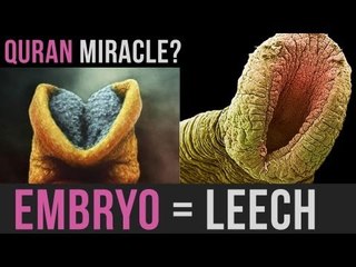 EMBRYO LEECH - AMAZING QURAN MIRACLE - #MINDBLOW